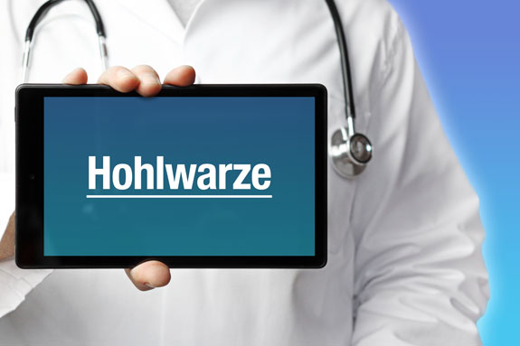Eingezogene Brustwarzen Hanau